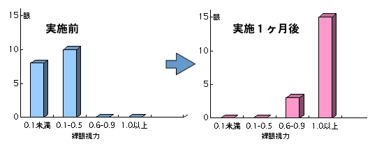 オルソケラトロジー実施前後の裸眼視力の比較 オルソケラトロジー実施前後の裸眼視力の比較グラフ